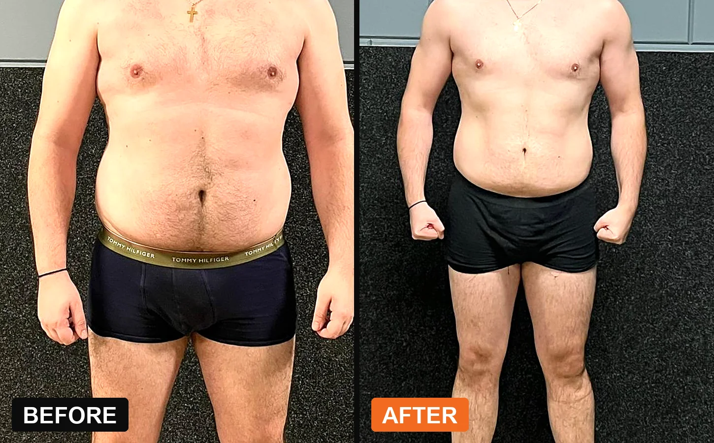 Client before and after: Client A · front